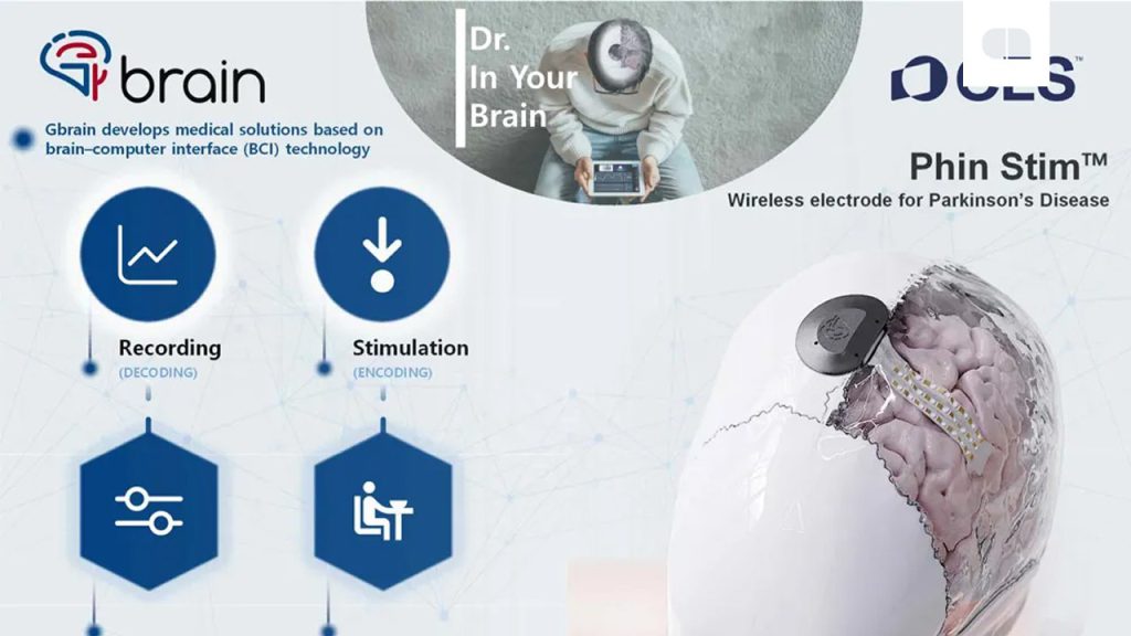 хвороба паркінсона